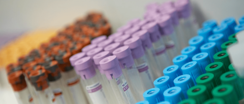 Imagen de archivo / TA